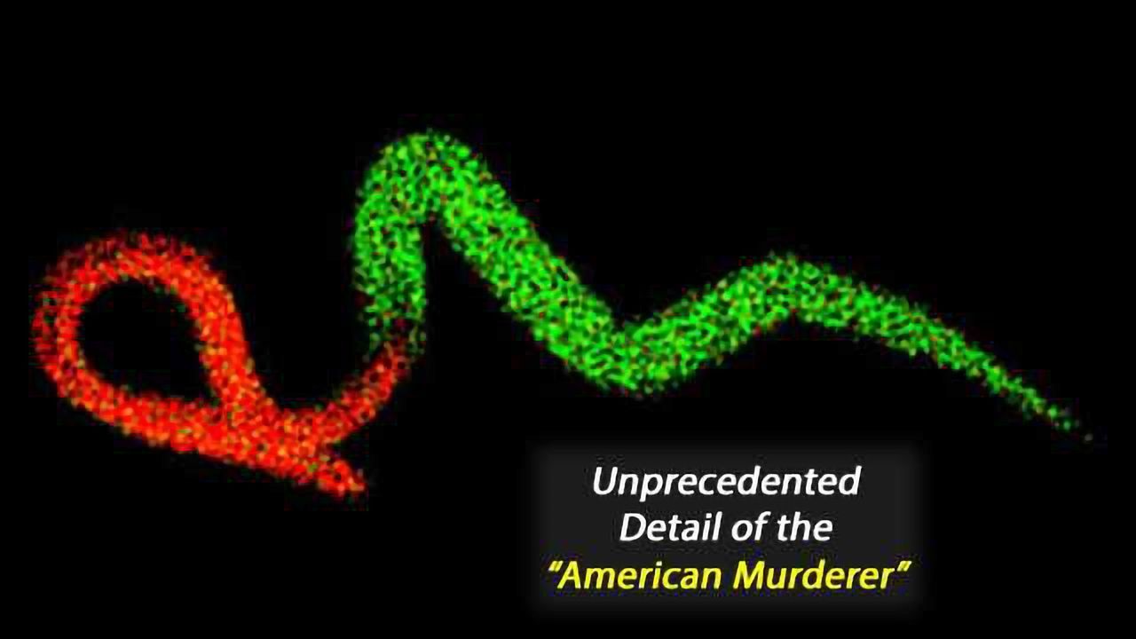 Physiochemical 'Fingerprint' of Parasitic 'American Murderer' Uncovered