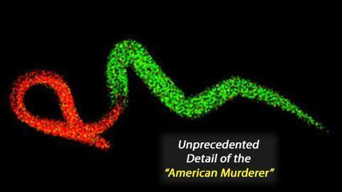 Physiochemical 'Fingerprint' of Parasitic 'American Murderer' Uncovered