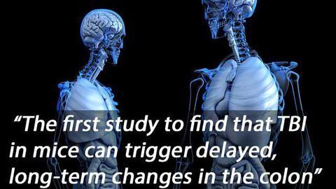 Traumatic Brain Injury Causes Intestinal Damage