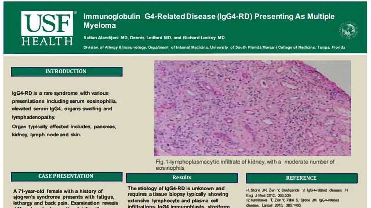 Immunoglobulin G4-Related Disease (IgG4-RD) Presenting As Multiple Myeloma