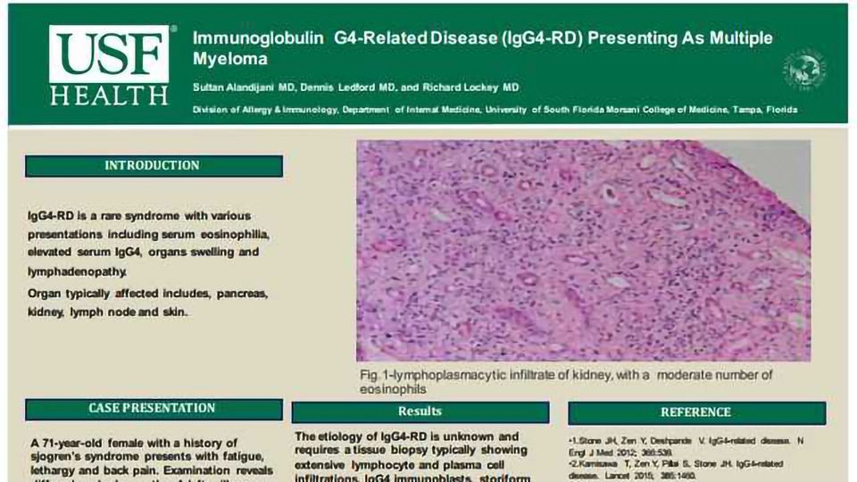 Immunoglobulin G4-Related Disease (IgG4-RD) Presenting As Multiple Myeloma content piece image