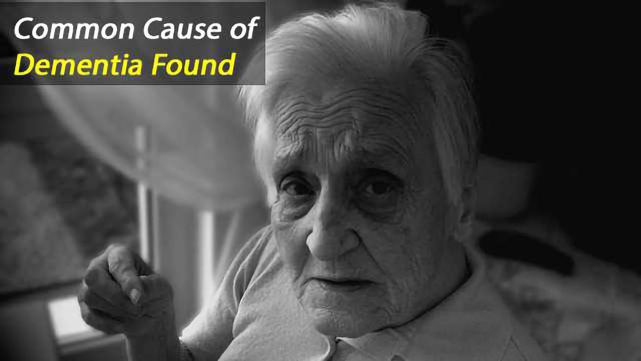Increased Urea Levels in Brain Linked with Dementia.