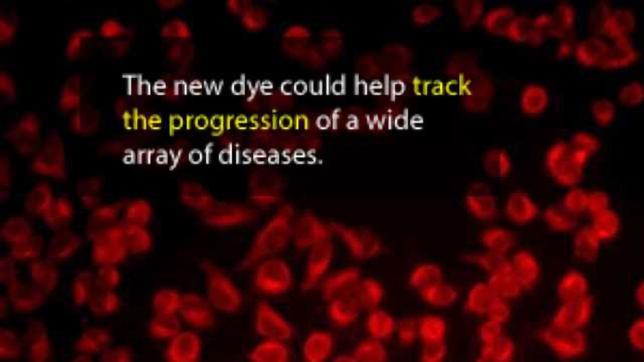 Newly Developed Dye, Washington Red, Could Advance Bioimaging