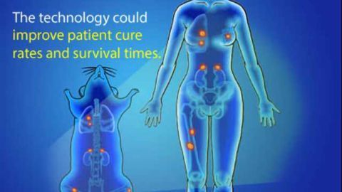 Faster, More Accurate Cancer Detection Using Nanoparticles