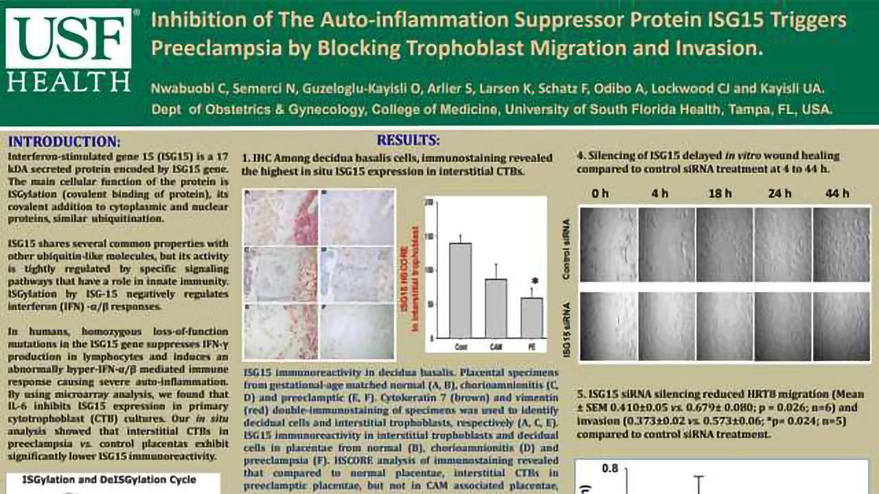 Inhibition of The Auto-inflammation Suppressor Protein ISG15 Triggers Preeclampsia by Blocking Trophoblast Migration and Invasion