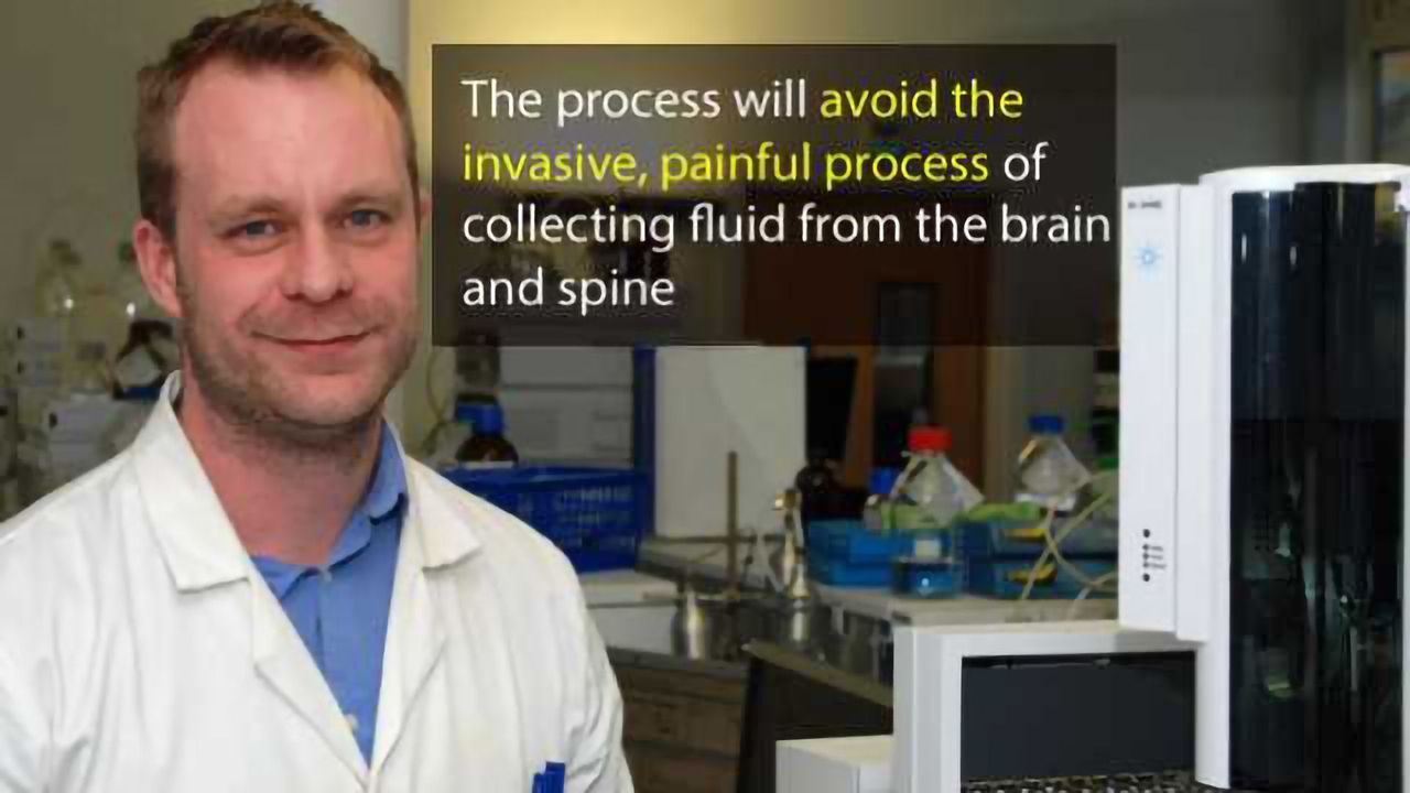 Blood Sample Detection Method for Multiple Sclerosis Discovered