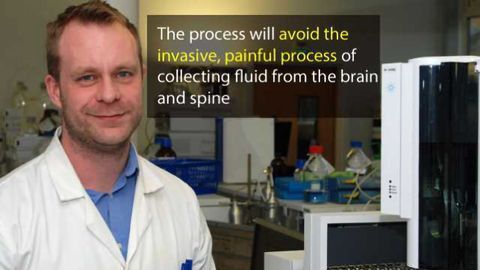 Blood Sample Detection Method for Multiple Sclerosis Discovered