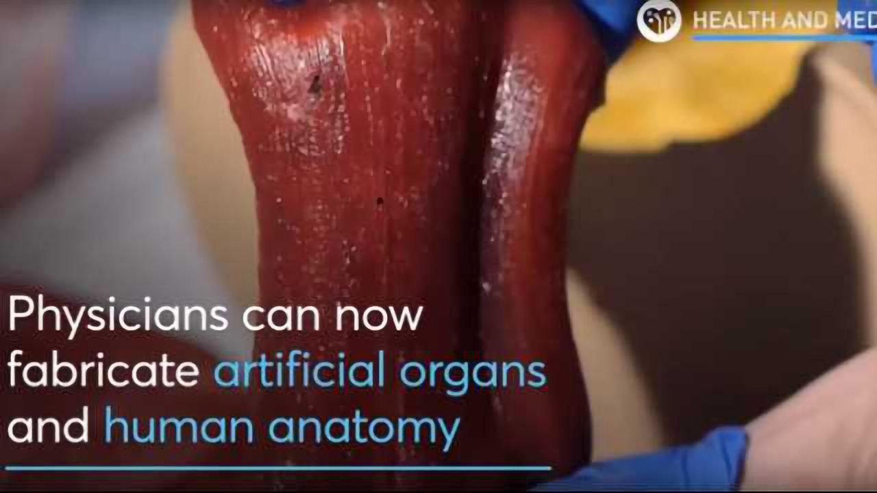 3D Printed Human Organs