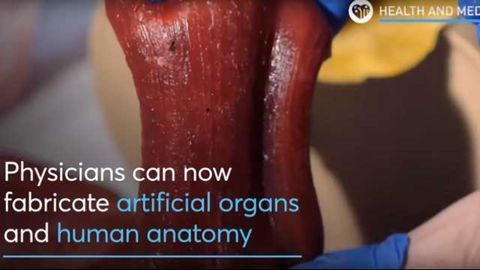 3D Printed Human Organs