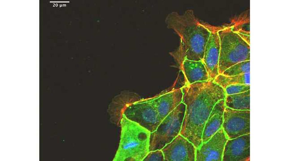 Highly Efficient Substrate for Culturing ES/iPS Cells content piece image
