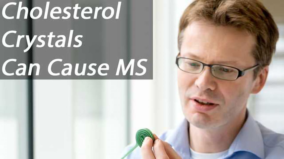 Crystals of Cholesterol Cause Multiple Sclerosis by Preventing