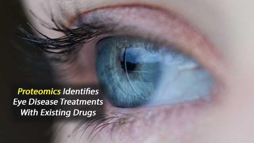 Protein Analysis Enables Treatment of EyeDisease Symptoms with