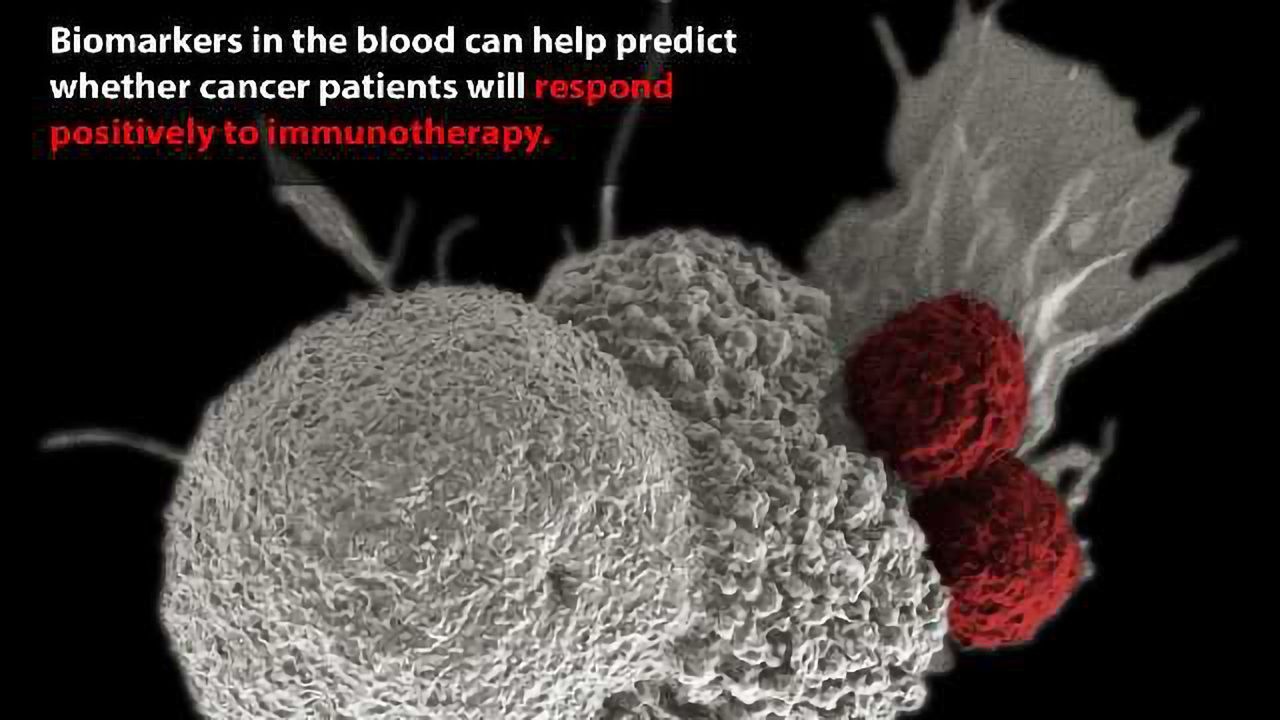 New Biomarkers Predict Outcome of Cancer Immunotherapy
