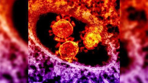 Safety and Efficacy of MERS Treatment Confirmed in Phase I Trial