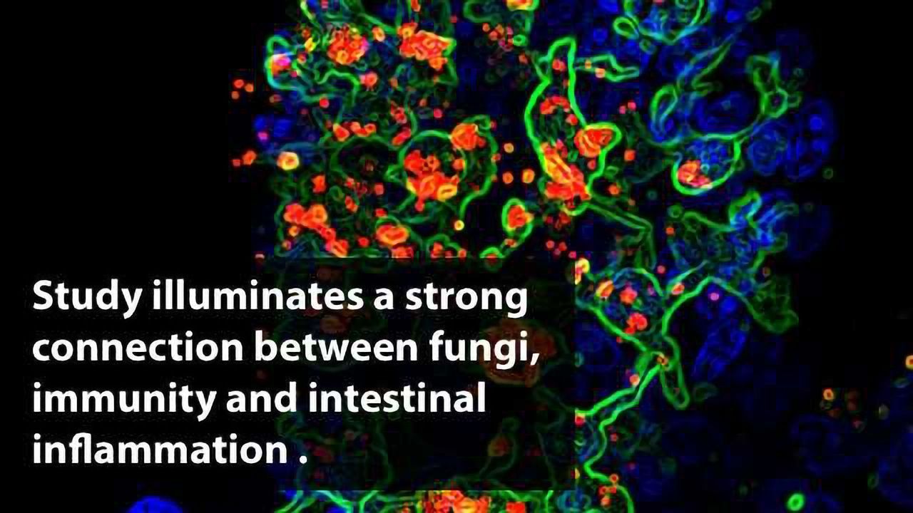 Immune Cells That Keep Gut Fungi Under Control Identified
