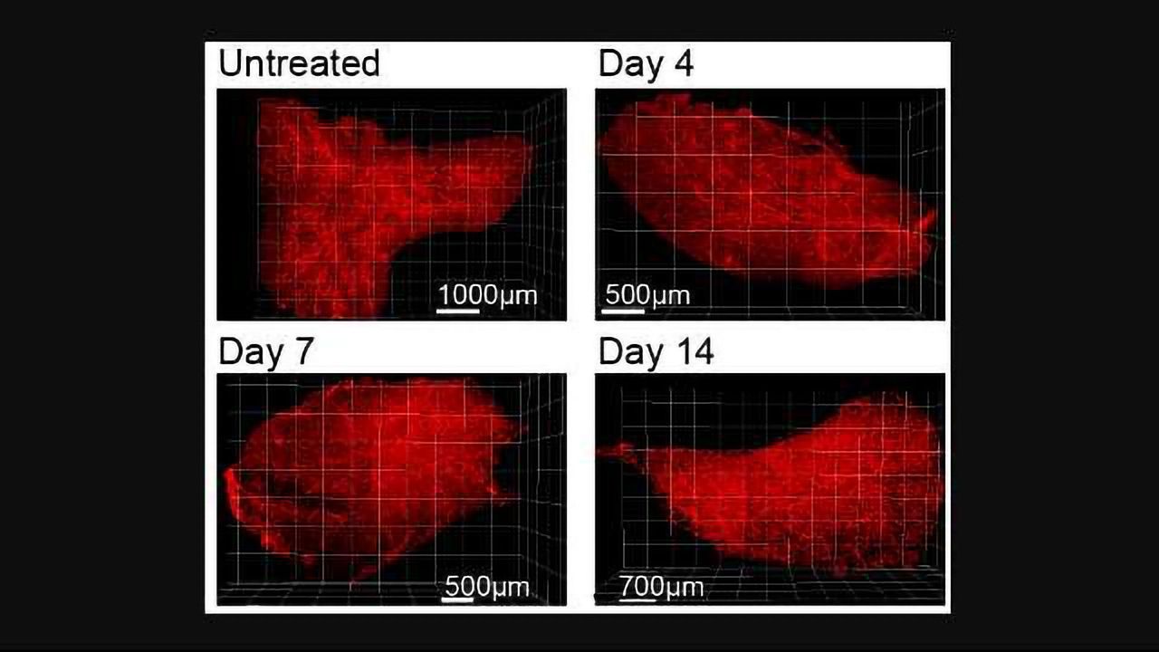 Regenerating the Thymus