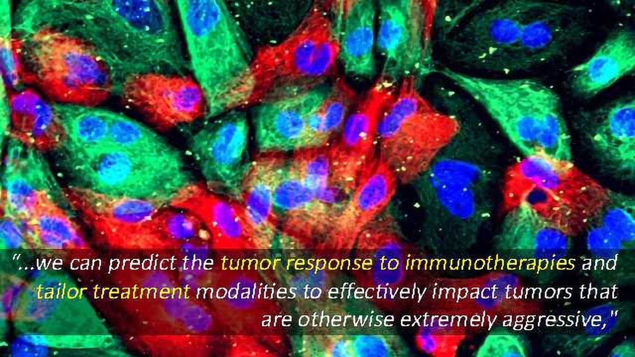Prostate Tumor Progression Dictated by Cancer’s Gene-determined “Immune Landscape”
