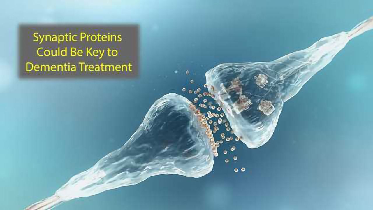 Synaptic Proteins May Be Starting Point for Dementia Treatment