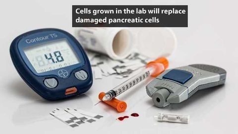 New Cell Therapy for Diabetes Being Tested