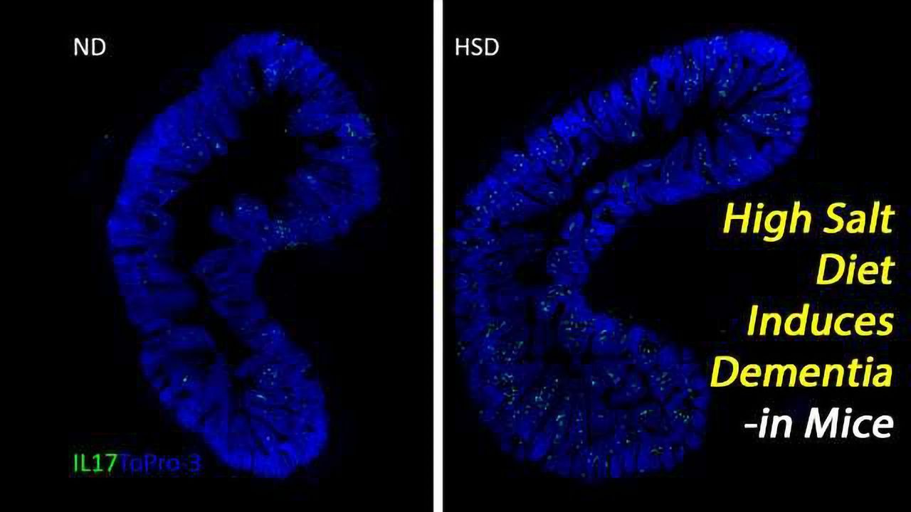 Gut-Brain Research Shows High Salt Intake Causes Dementia -in Mice