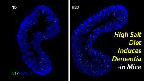 Gut-Brain Research Shows High Salt Intake Causes Dementia -in Mice