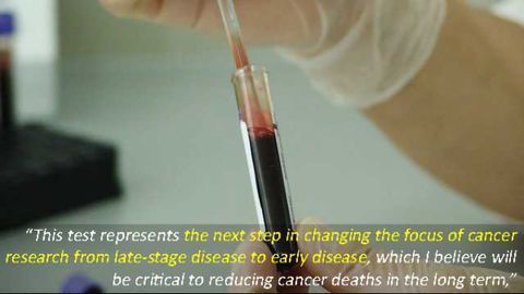 Single Blood Test 'CancerSEEK' Screens for Eight Cancer Types