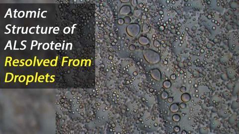 All in a Droplet: Atomic Resolution of ALS Protein Resolved