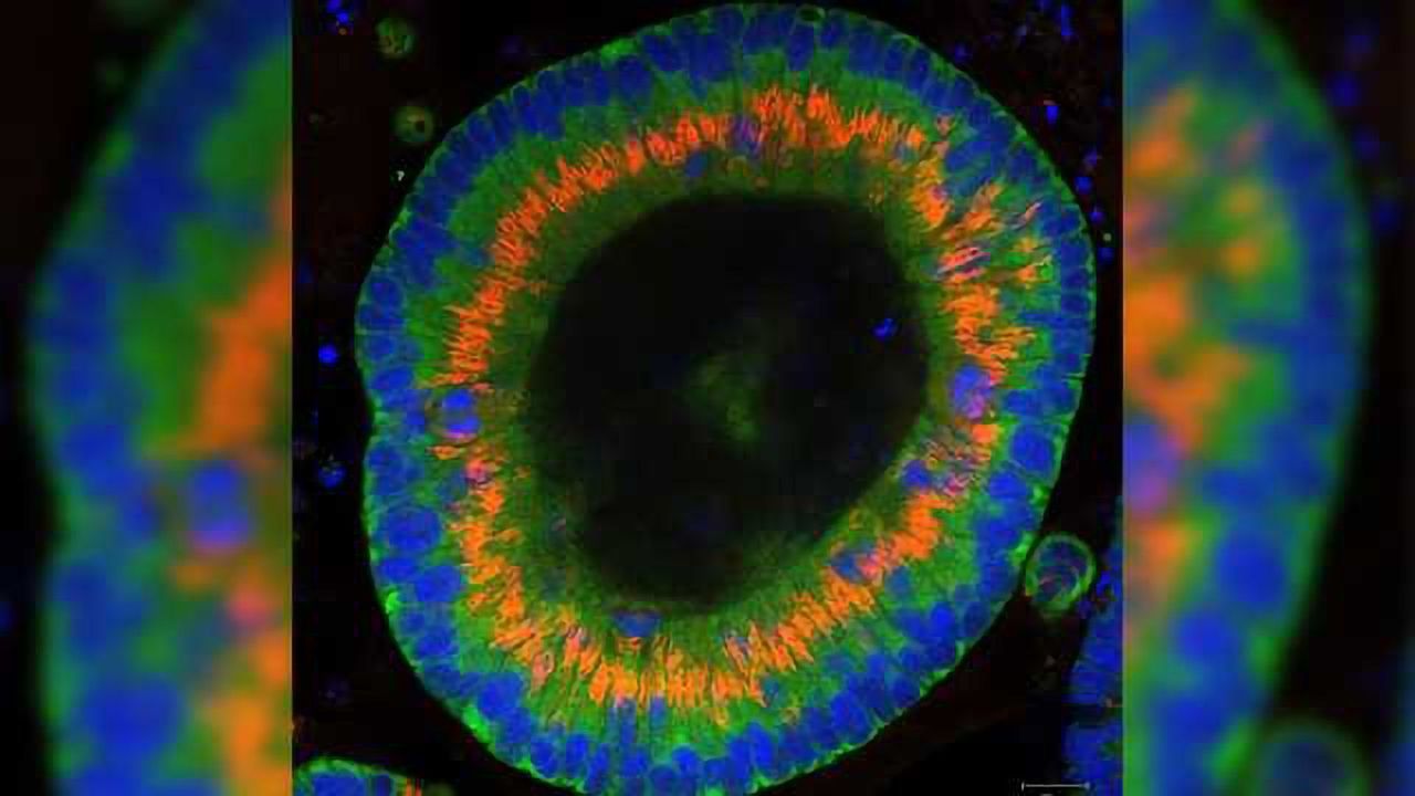 Cancer Stem Cell Survival is Controlled by Hedgehog Signaling Proteins