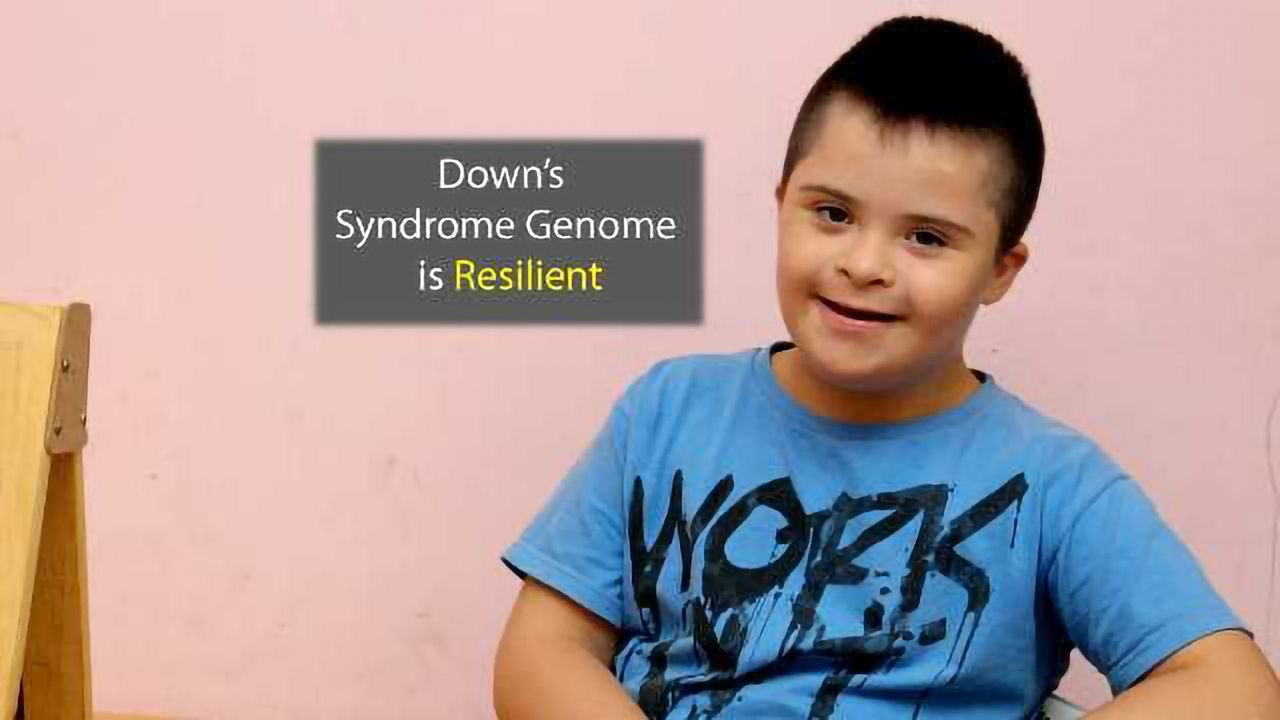 The Resilience of the Down's Syndrome Genome