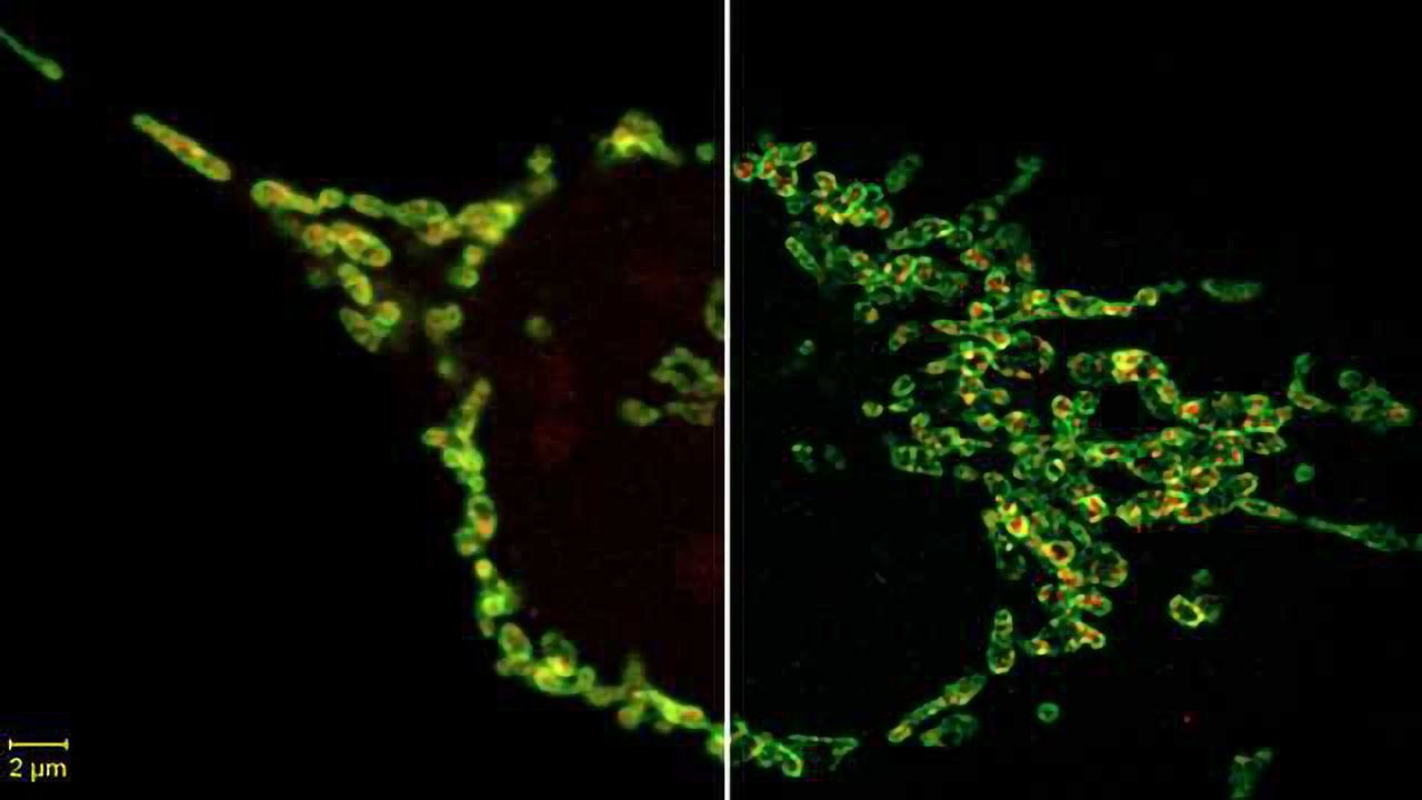 New 2D Superresolution Mode for ZEISS Airyscan Delivers 120 nanometer Lateral Resolution