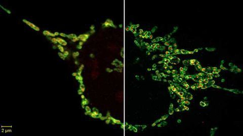 New 2D Superresolution Mode for ZEISS Airyscan Delivers 120 nanometer Lateral Resolution