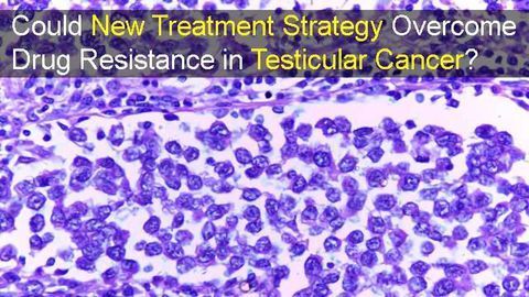 Could New Treatment Strategy Overcome Drug Resistance in Testicular Cancer?