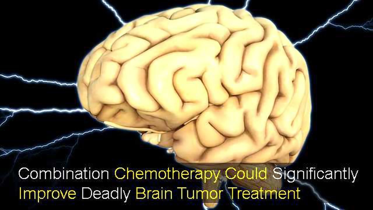 Combination Chemotherapy Could Significantly Improve Deadly Brain Tumor Treatment