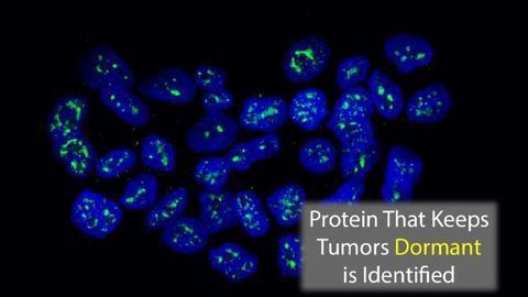 Protein That Helps Keep Breast Cancer Dormant Identified