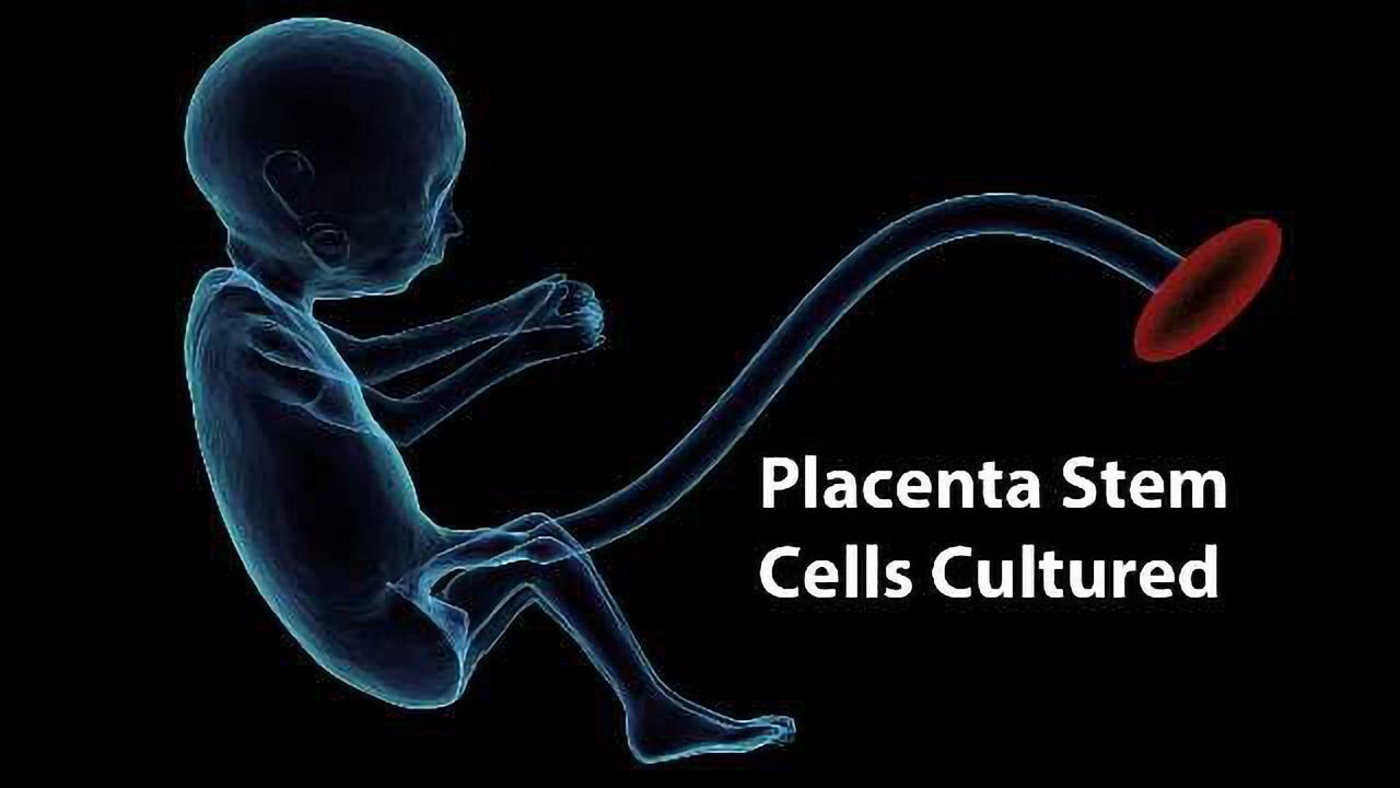 Human Placenta Stem Cells Cultured for the First Time