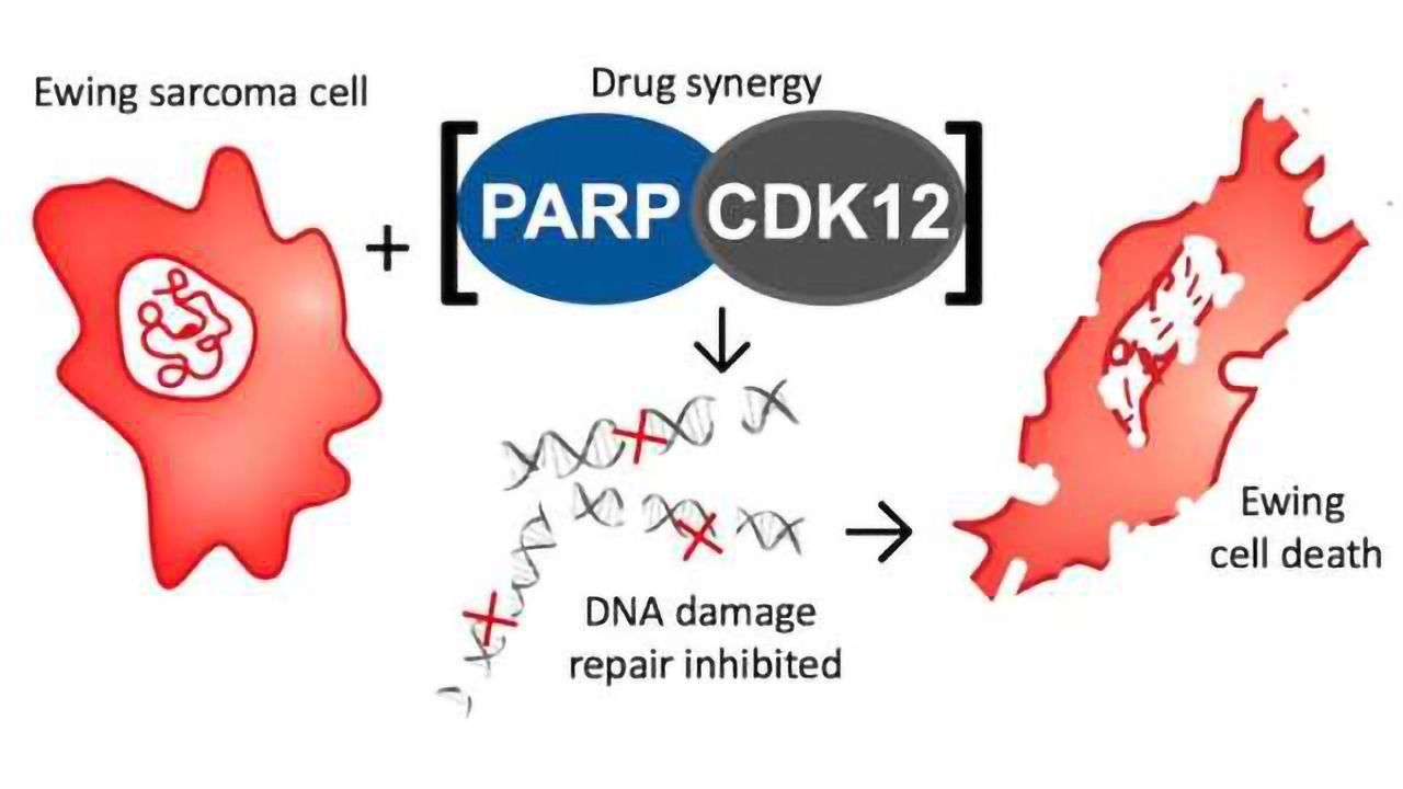 Drug Target for Ewing Sarcoma Identified