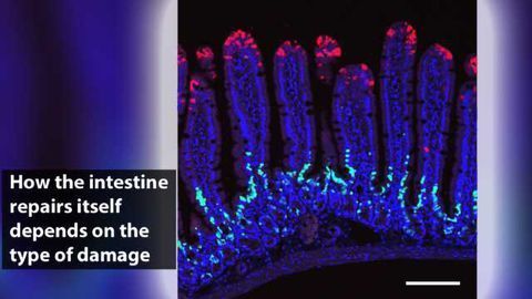 How the Intestine Repairs Itself