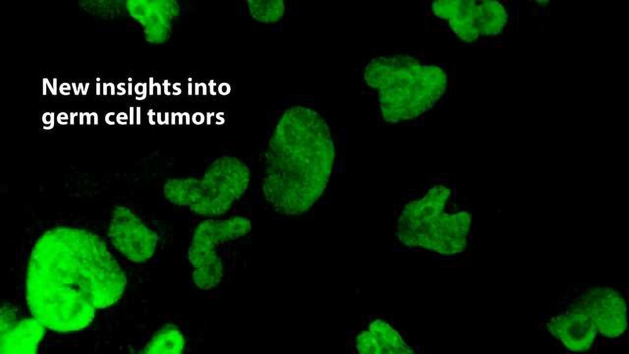 Stem Cells Used to Study Genetics of Germ Cell Tumors
