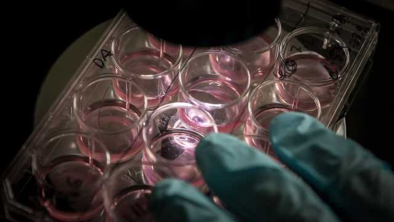 Reprogramming and iPSC Formation - Then and Now
