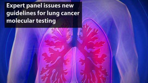 New Guidelines for Lung Cancer Molecular Testing Issued