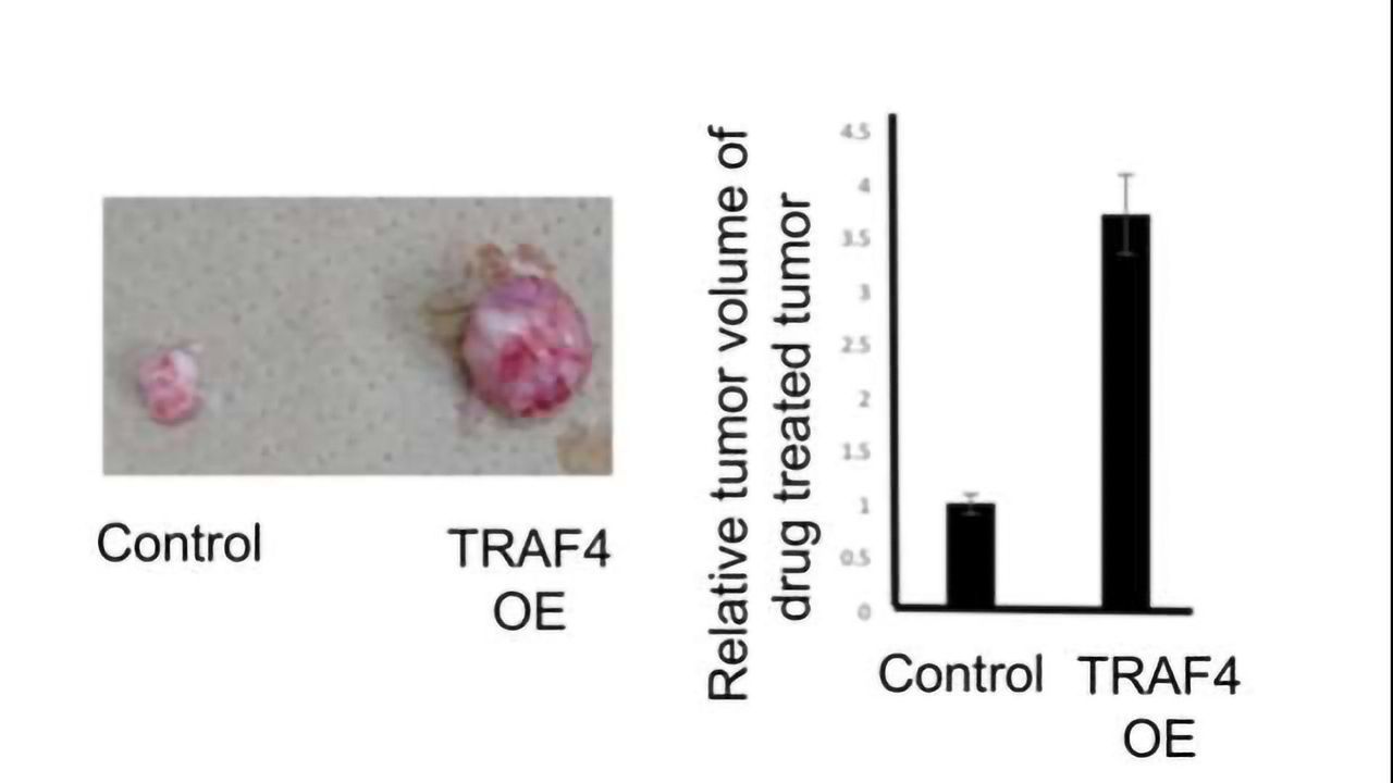 Chemoresistance Drug Targets Revealed Using Computational Methods