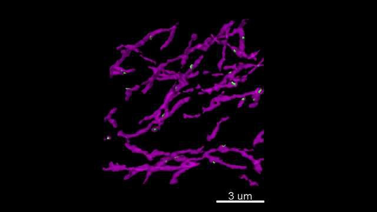 Sparse 'Active-Zone-Like' Release Sites for Dopamine Discovered