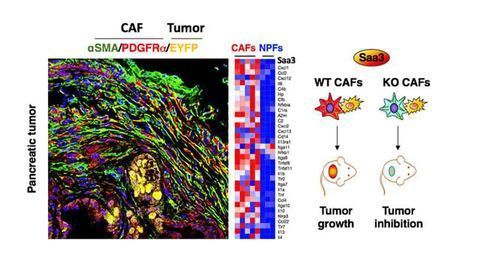 New Therapeutic Strategy for Pancreatic Cancer?