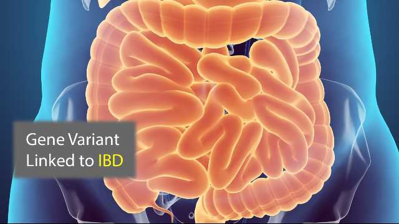 Protein Recycling Plant Malfunctions in Inflammatory Bowel Disease
