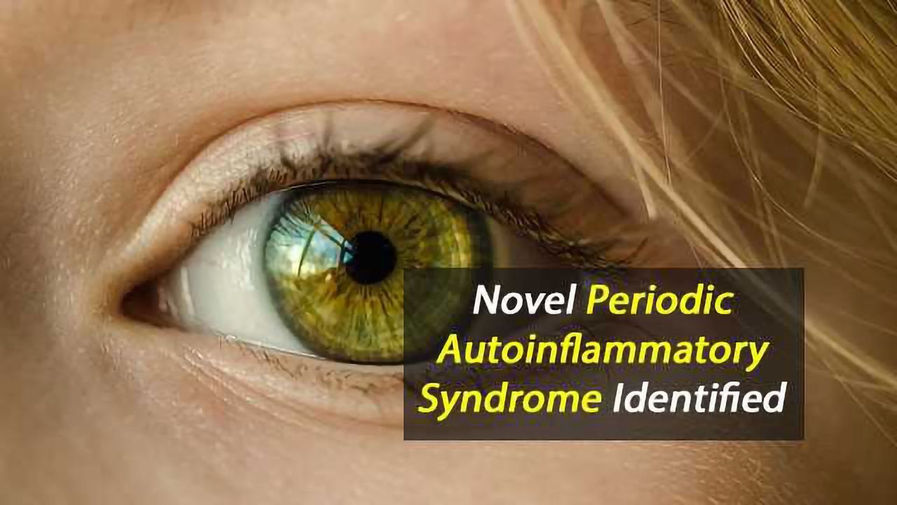 Cause of Corneal Autoinflammatory Condition Identified