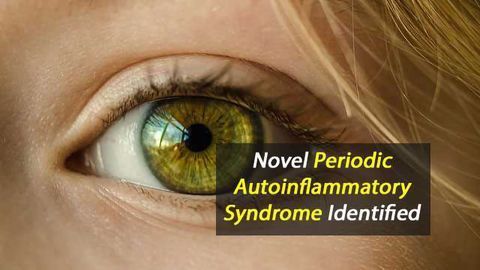 Cause of Corneal Autoinflammatory Condition Identified