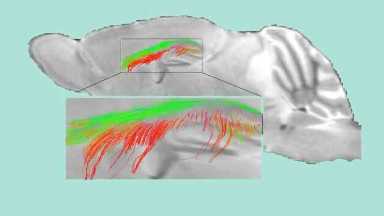 Half of All Dementias, Including Alzheimer’s, Start With Damaged ‘Gatekeeper Cells’
