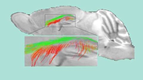 Half of All Dementias, Including Alzheimer’s, Start With Damaged ‘Gatekeeper Cells’