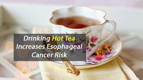 Drinking Hot Tea Associated With 5-Fold Increased Risk for Esophageal Cancer