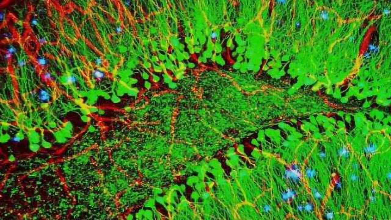 Compound Prevents Neurological Damage, Shows Cognitive Benefits in Mouse model of Alzheimer’s Disease